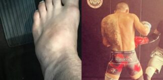 Leaked Video Shows The Moment Rafael dos Anjos Got Injured