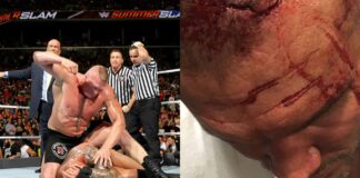 Brock Lesnar Crushes Randy Orton’s Skull By Accident