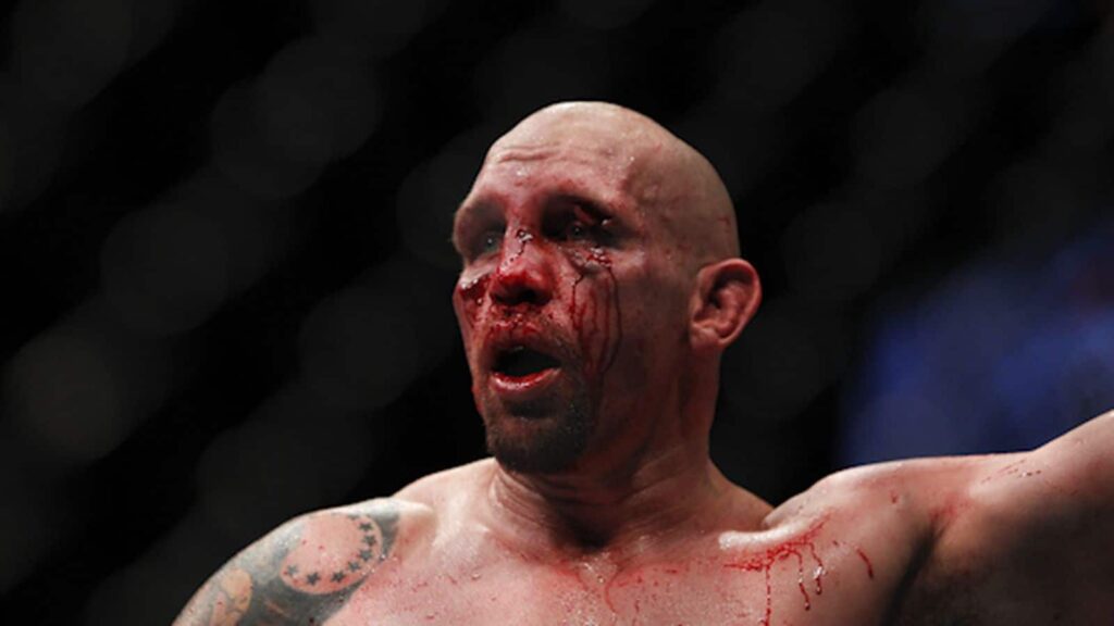 Shane_Carwin_bloody_face