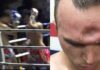 WATCH: Muay Thai Elbow Instantly Fractures Fighter’s Skull