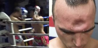 WATCH: Muay Thai Elbow Instantly Fractures Fighter’s Skull