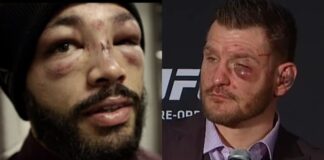 Before & After: You’ll Barely Recognise Some Fighters From UFC 220