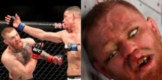 Nate Diaz Reminds Conor McGregor About UFC 196…Again