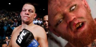 Nate Diaz Explains How He Knocked Conor McGregor Out