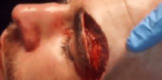 WATCH: Sickening Footage Released of Worst MMA Cut Ever