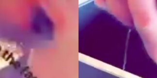 WATCH: Nick Diaz Squeezing Elbow Infection is Just Disgusting