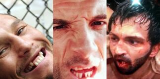 10 Times MMA Fighters Got Their Teeth Knocked Out
