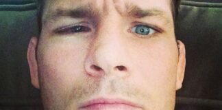 10 MMA Fighter’s Who Suffered A Career-Ending Injury In The Cage