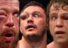 Top 20 Worst Eye Injuries In MMA History